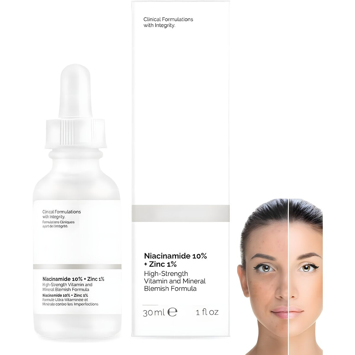 REF_P_1_The Ordinary Niacinamide 10%+Zink 1% 30 Ml
