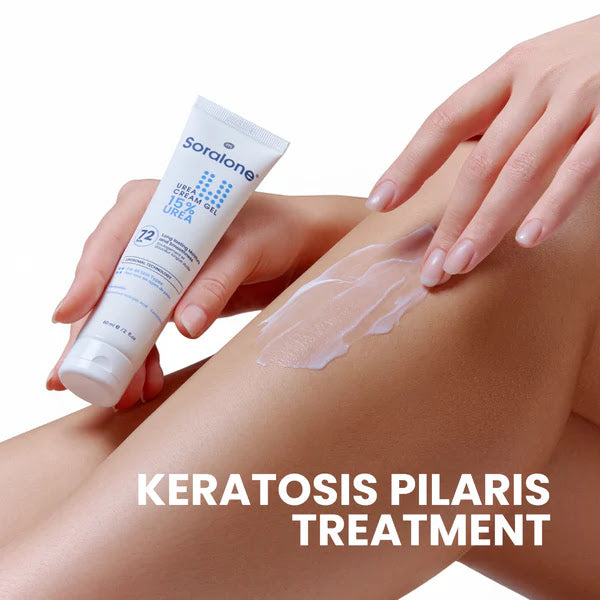 Soralone Urea Cream Gel 60 ml
